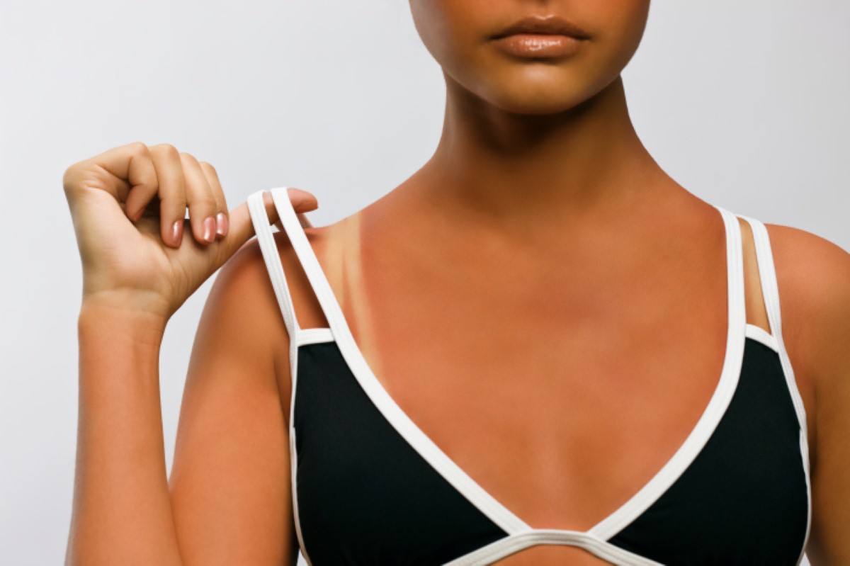 Skin cancer specialists want people to be responsible this summer