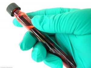 The caravans will be used to help locals get tested