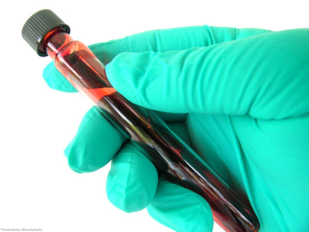 The caravans will be used to help locals get tested